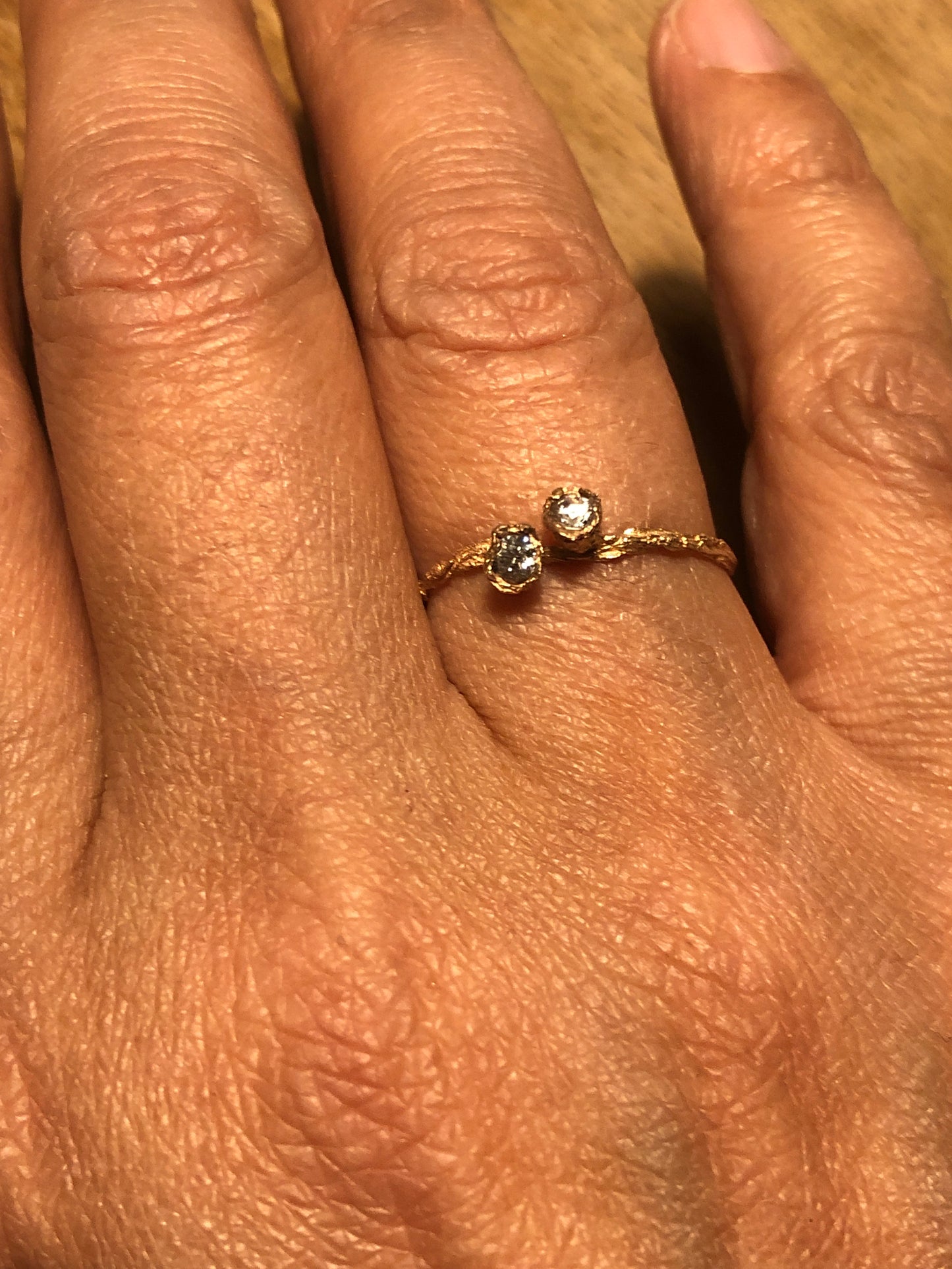 Anello Calistemone